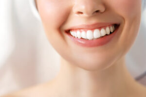 Picture of a woman smiling with bright, white teeth.